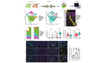 SXR2023040002C+脑膜瘤类器官与scRNA-seq结合发现肿瘤关键亚群及新的治疗策略