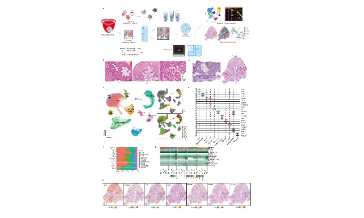SXR2023030038C_jing_单细胞结合空间转录数据的38+癌前病变研究方案